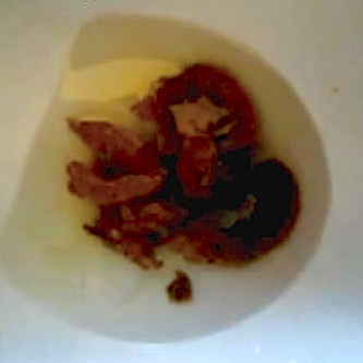 Big+Poop+in+Toilet woman records herself shitting and farting while sitting on a toilet ...