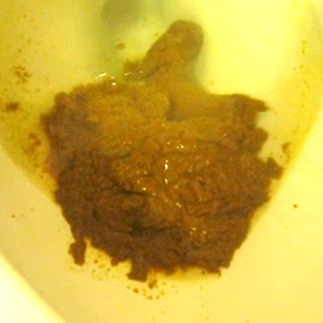 Big+Poop+in+Toilet TheNewGirlsPooping.Com A brunette woman takes a soft, somewhat runny ...